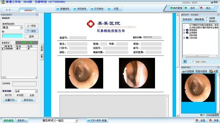 巨渺耳鼻喉镜工作站软件