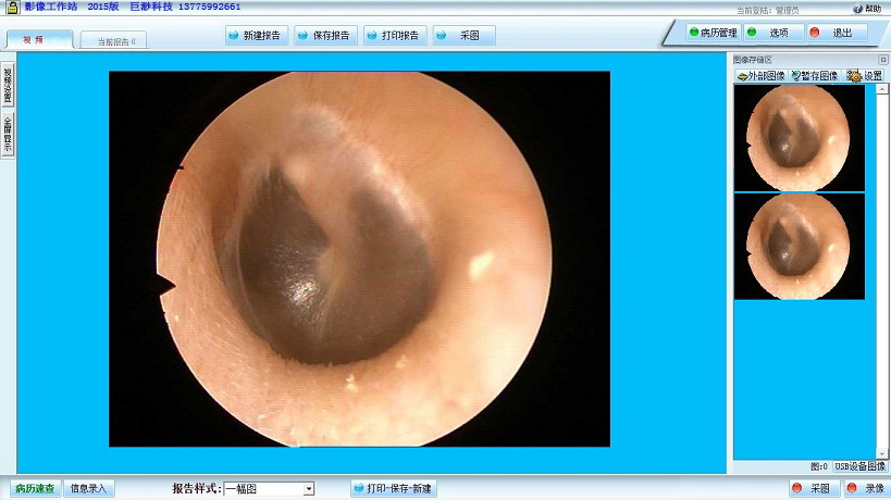 巨渺耳鼻喉镜工作站软件