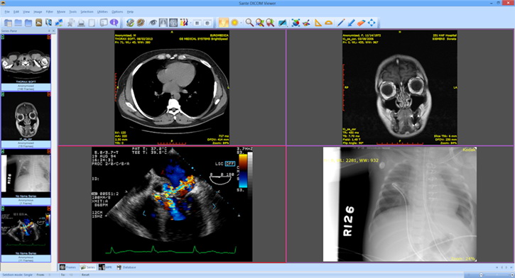 Sante DICOM Viewer