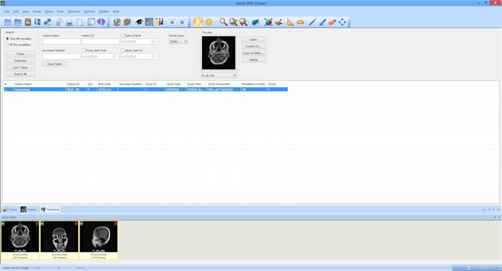 Sante MRI Viewer