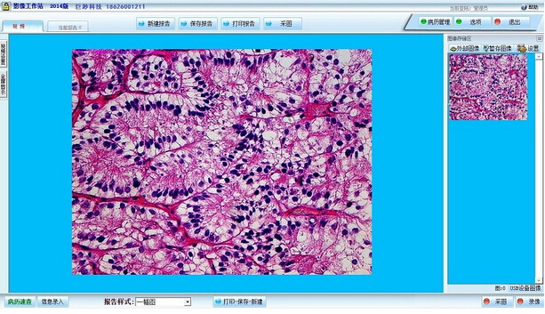 病理图文报告系统