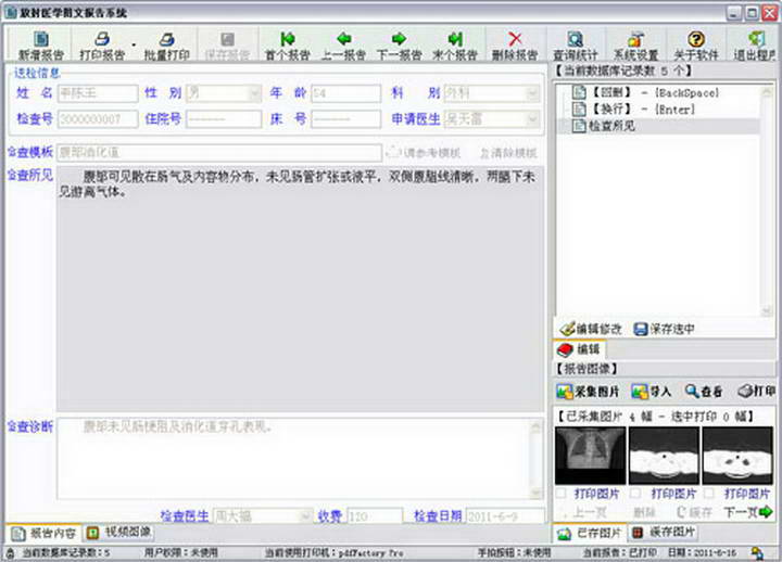 锐影医学影像腹腔镜图文报告系统