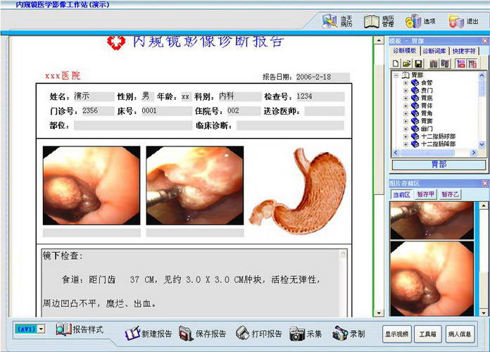 电子胃肠镜工作站软件