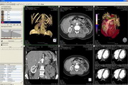 VTK Standalone Python Interface For Darwin(64bit)