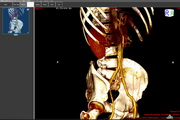 ORPALIS DICOM Viewer