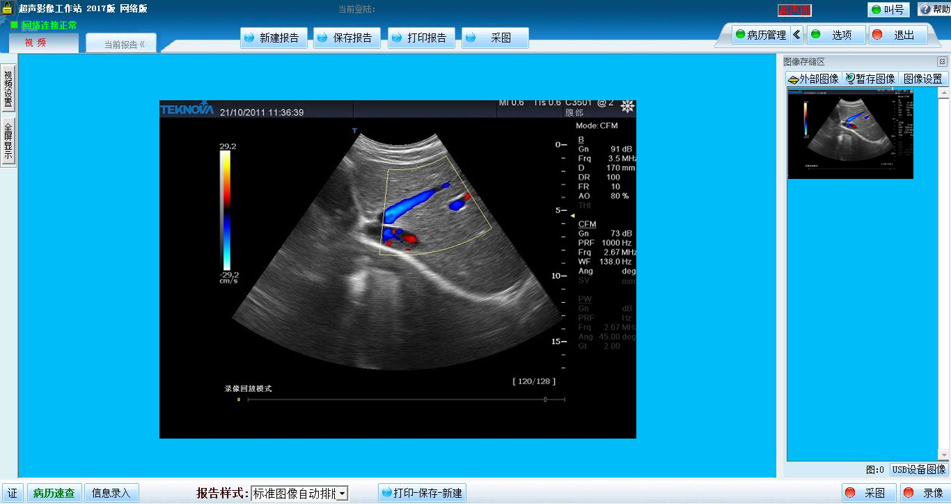 巨渺超声影像工作站网络系统