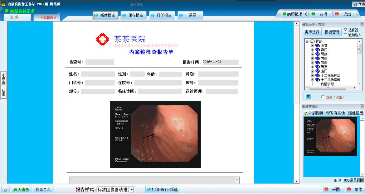 巨渺内窥镜工作站网络系统