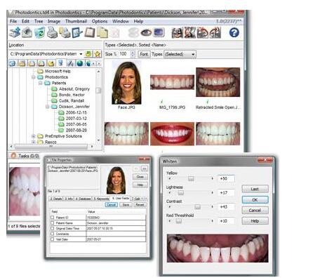Photodontics Pro(牙科图像管理系统)