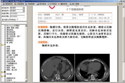 医学MRI报告系统